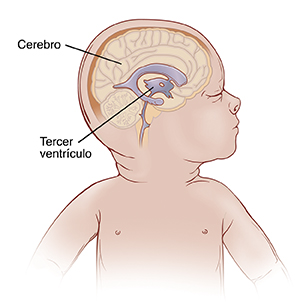 Vista lateral de la cabeza de un bebé donde se observan los ventrículos normales en el cerebro.