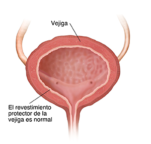 Corte transversal de la vejiga.